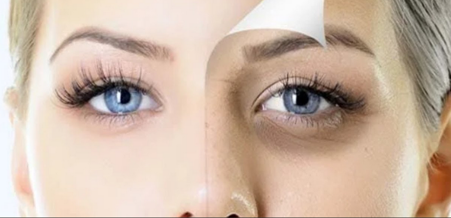 بوصفات طبيعية 100% تخلصي من الهالات السوداء حول العين خلال أيام
