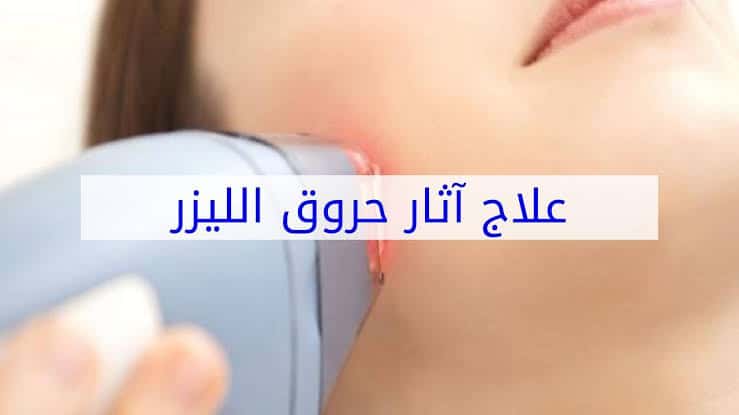 التخلص من آثار حروق الليزر