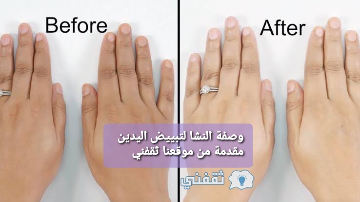 "مكون