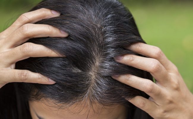 علاج شيب الشعر بدون غسل الشعر وبدون أي مواد كيميائيّة أو صبغات أحمي شعرك من التساقط والشيب