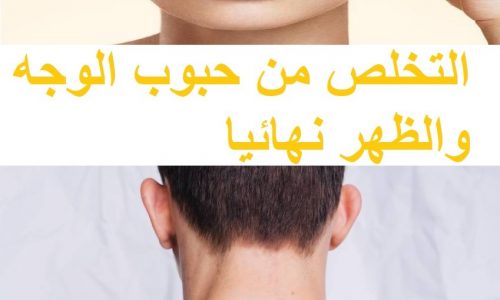 التخلص من حبوب الوجه والظهر نهائيا