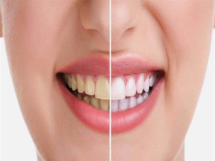 وصفة معجزة لتبييض الأسنان وإزالة الجير والأصفرار نهائياً لأسنان بيضاء كاللؤلؤ من أول أستعمال