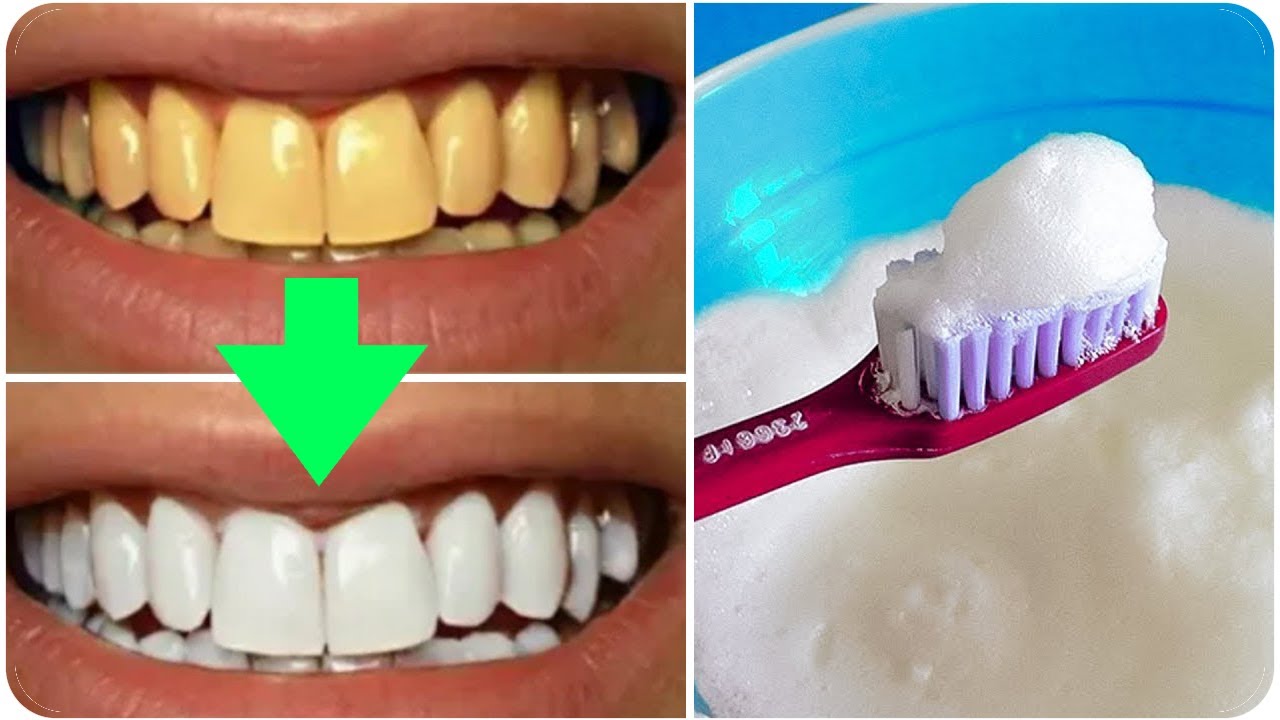 انقذ أسنانك.. تبييض الأسنان في البيت بمكون سحري بسيط ووداعاً لطبيب الأسنان