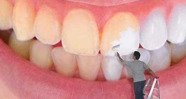 علاج اصفرار الاسنان بوصفات منزلية طبيعية