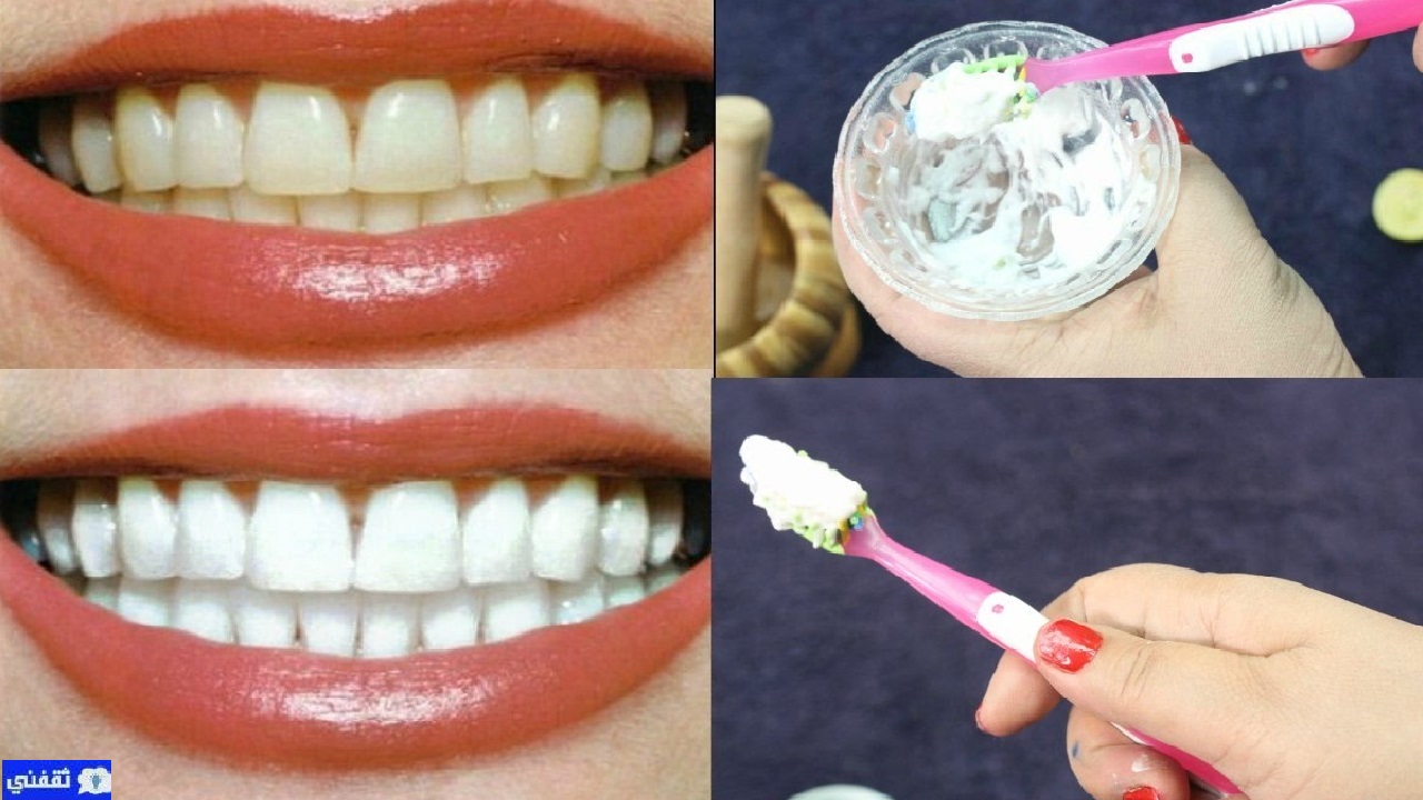 وصفة طبيعية سحرية لتبييض الأسنان وإزالة الجير المتراكم في دقائق معدودة