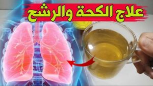 دواء للكحة ببلغم علاج الكحة والبلغم بالأعشاب