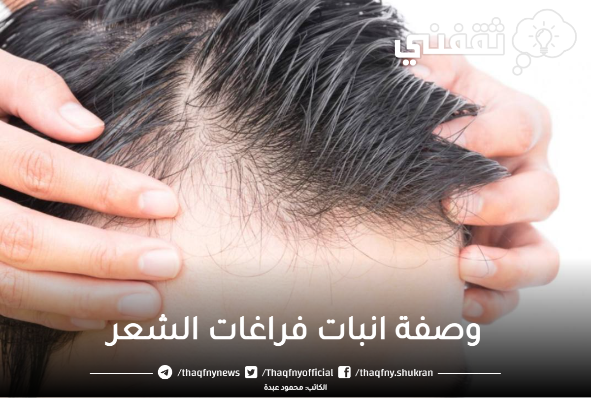 وصفة طبيعية لإنبات الشعر وملئ الفراغات في اسرع وقت بطرق طبيعية والنتيجة مذهلة