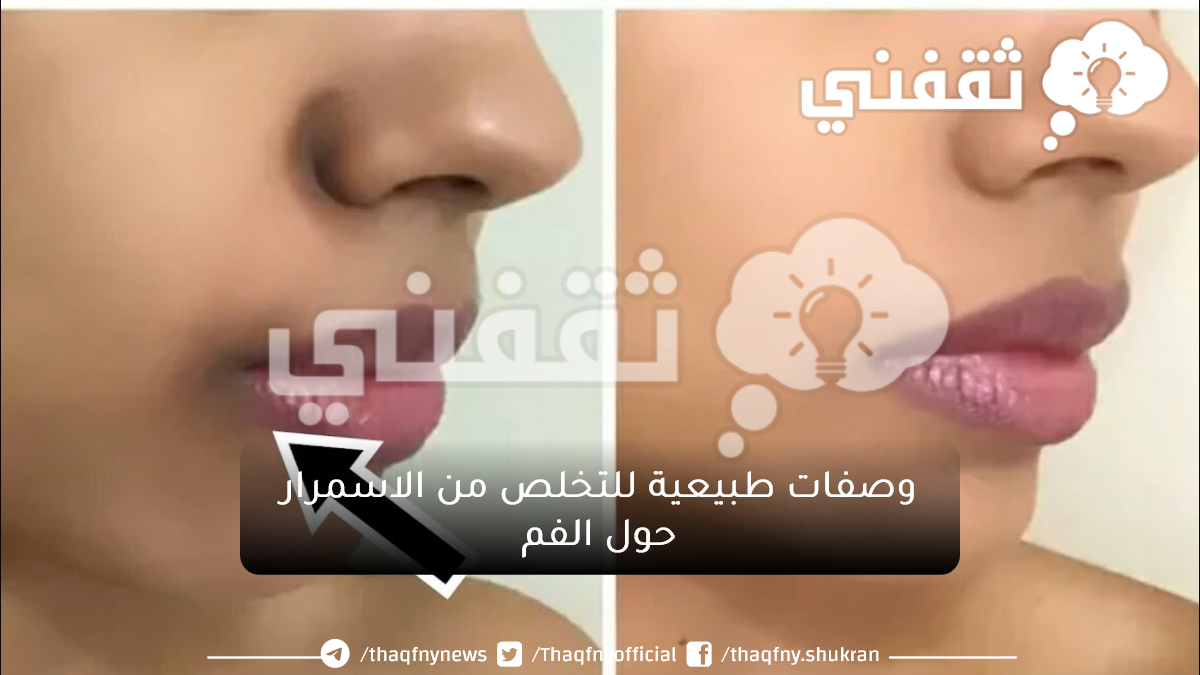 بديل الليزر.. وصفات طبيعية للتخلص من الاسمرار حول الفم بخطوات بسيطة