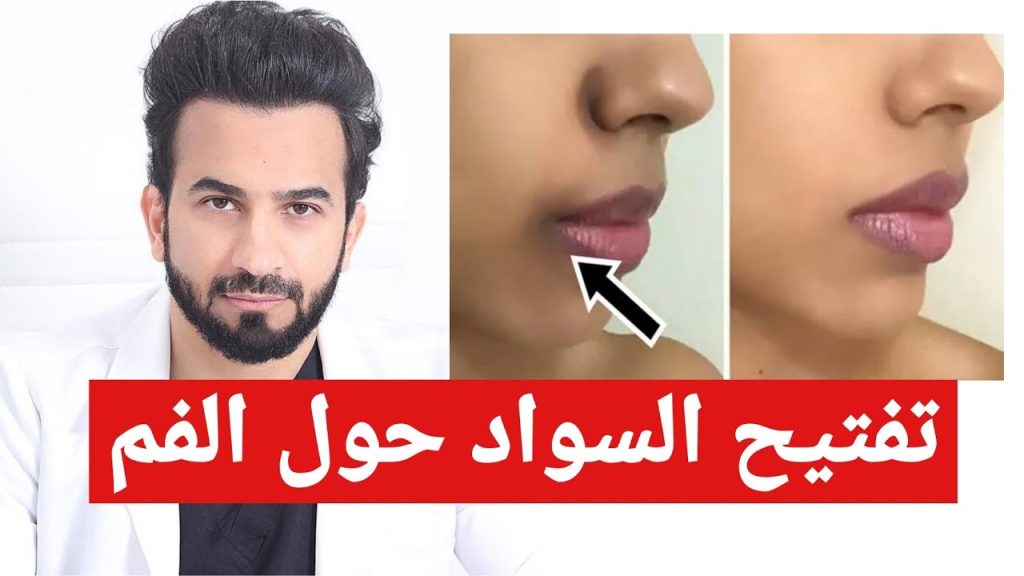 اسمرار المنطقة حول الفم