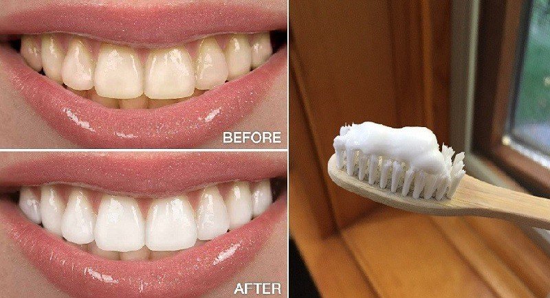 اسهل طريقة لعمل معجون الأسنان في منزلك لعلاج التسوس والتهاب اللثة وإزالة الجير والاصفرار