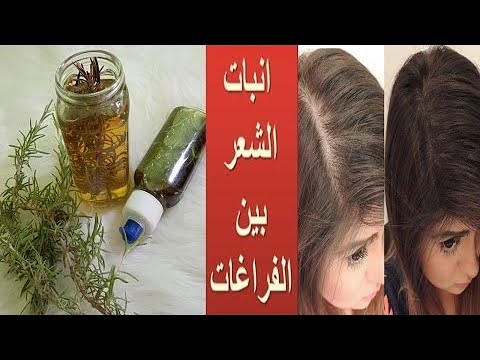 استخدامات زيت اكليل الجبل للشعر 