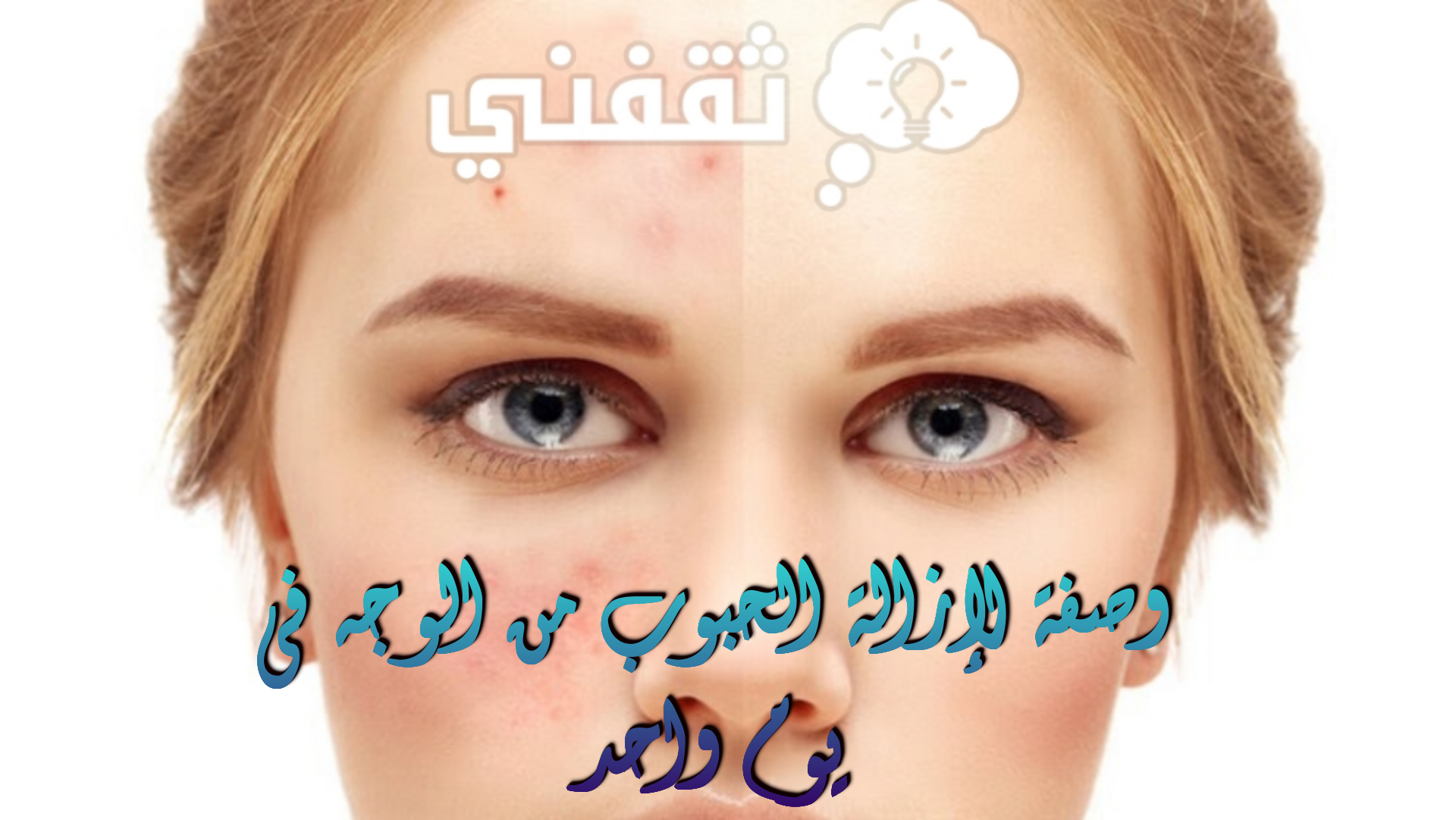 وصفة لإزالة الحبوب من الوجه في يوم واحد وماسك لتفتيح لون البشرة في أسبوع